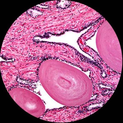 AmScope B100-3M Digital Compound Binocular Microscope, 40X-1000X Magnification, Brightfield, Tungsten Illumination, Abbe Condenser, Plain Stage, Includes 3MP Camera with Reduction Lens and Software